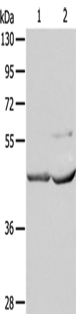 Western Blot analysis of Mouse kidney and heart tissue using NCEH1 Polyclonal Antibody at dilution of 1:1350