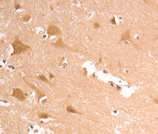 Immunohistochemistry of paraffin-embedded Human brain using AASDHPPT Polyclonal Antibody at dilution of 1:30