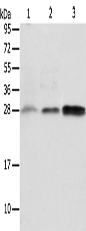 Western Blot analysis of Human fetal liver and seminoma tissue, RAW264.7 cell using ALKBH2 Polyclonal Antibody at dilution of 1:650