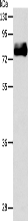 Western Blot analysis of Mouse heart tissue using ABLIM1 Polyclonal Antibody at dilution of 1:550