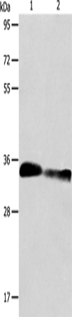 Western Blot analysis of Mouse kidney and Rat kidney tissue using ACY3 Polyclonal Antibody at dilution of 1:750