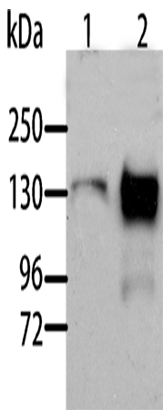 Western Blot analysis of Human liver cancer and normal liver tissue using AOX1 Polyclonal Antibody at dilution of 1:1000