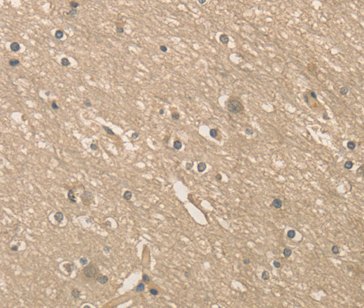 Immunohistochemistry of paraffin-embedded Human brain  using ALDH8A1 Polyclonal Antibody at dilution of 1:40