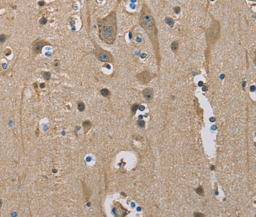 Immunohistochemistry of paraffin-embedded Human brain tissue using SERPINA1 Polyclonal Antibody at dilution 1:50