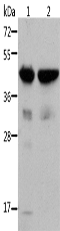Western Blot analysis of Mouse muscle and heart tissue using ACTA1 Polyclonal Antibody at dilution of 1:500