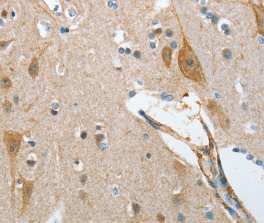 Immunohistochemistry of paraffin-embedded Human brain tissue using NOL3 Polyclonal Antibody at dilution 1:35