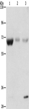 Western Blot analysis of Human fetal muscle, kidney and liver tissue using NAE1 Polyclonal Antibody at dilution of 1:500