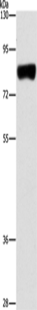 Western Blot analysis of Hela cell using ARHGAP25 Polyclonal Antibody at dilution of 1:500