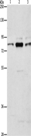 Western Blot analysis of Human brain malignant glioma tissue, A172 and 293T cell using ARHGEF7 Polyclonal Antibody at dilution of 1:800