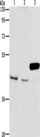 Western Blot analysis of A172 and K562 cell, Mouse pancreas tissue using ARMCX3 Polyclonal Antibody at dilution of 1:900