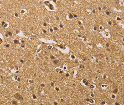 Immunohistochemistry of paraffin-embedded Human brain  tissue using PRDM14 Polyclonal Antibody at dilution 1:40