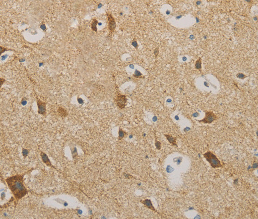 Immunohistochemistry of paraffin-embedded Human brain using IDH3G Polyclonal Antibody at dilution of 1:30