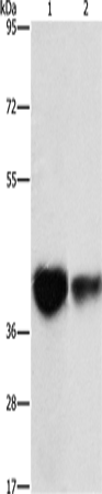 Western Blot analysis of Mouse brain tissue and NIH/3T3 cell using IDH3G Polyclonal Antibody at dilution of 1:350