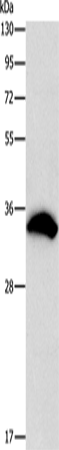 Western Blot analysis of 293T cell using CDCA8 Polyclonal Antibody at dilution of 1:800