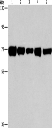 Western Blot analysis of Hela, A549 and MCF7 cell, Human liver cancer and lung cancer tissue using RPN1 Polyclonal Antibody at dilution of 1:550