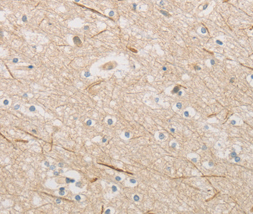 Immunohistochemistry of paraffin-embedded Human brain  tissue using ZWINT Polyclonal Antibody at dilution 1:50