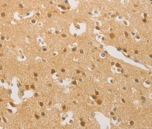 Immunohistochemistry of paraffin-embedded Human brain  tissue using HIPK4 Polyclonal Antibody at dilution 1:30