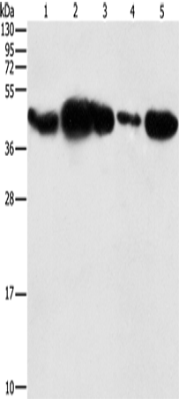 Western Blot analysis of HepG2 cell and Human fetal placenta tissue, 293T cell and Human testis tissue, NIH/3T3 cell using PGK2 Polyclonal Antibody at dilution of 1:600