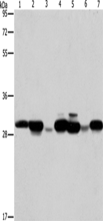 Western Blot analysis of Human placenta tissue and A549 cell, Mouse brain tissue and hepG2 cell, Raji cell and Human fetal liver tissue, hela cell using AK2 Polyclonal Antibody at dilution of 1:250