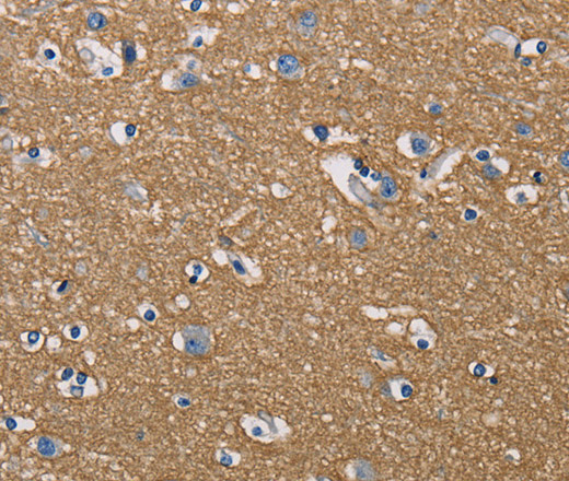 Immunohistochemistry of paraffin-embedded Human brain using GPM6A Polyclonal Antibody at dilution of 1:50