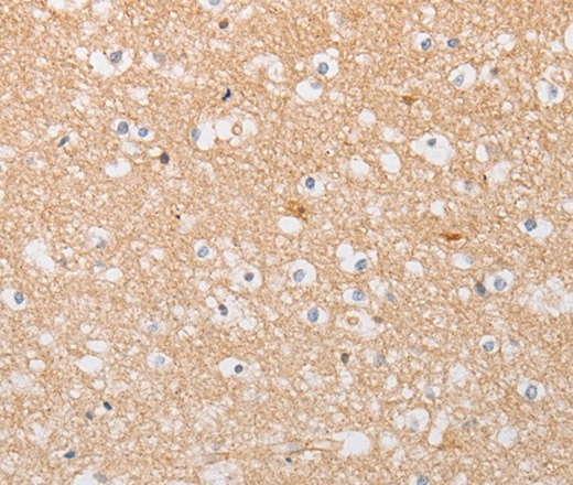 Immunohistochemistry of paraffin-embedded Human brain using ATG9A Polyclonal Antibody at dilution of 1:30