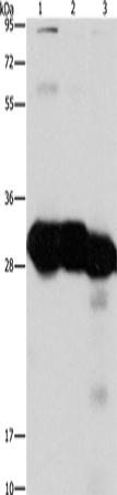 Western Blot analysis of Mouse liver and kidney tissue, Human fetal liver tissue using KHK Polyclonal Antibody at dilution of 1:1350