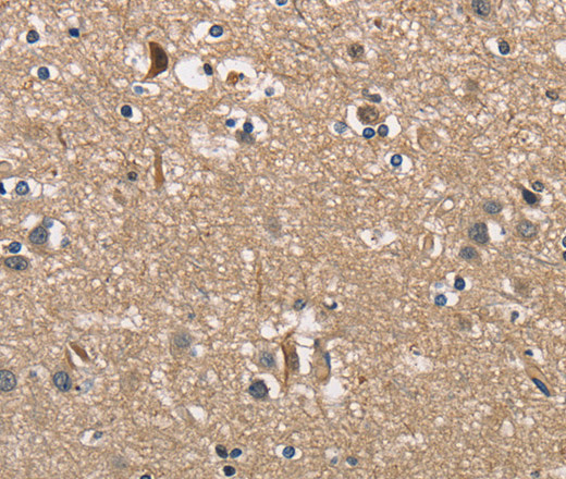 Immunohistochemistry of paraffin-embedded Human brain  using PGK1 Polyclonal Antibody at dilution of 1:40