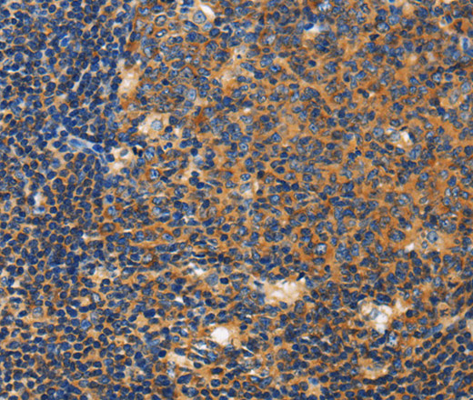 Immunohistochemistry of paraffin-embedded Human tonsil tissue using CERK Polyclonal Antibody at dilution 1:50