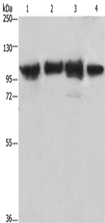 Western Blot analysis of Lovo cell and Mouse kidney tissue, 231 and hepG2 cell using ACTN4 Polyclonal Antibody at dilution of 1:485