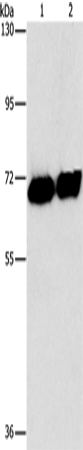 Western Blot analysis of HepG2 cell and Human placenta tissue using Placental Alkaline Phosphatase Polyclonal Antibody at dilution of 1:1550