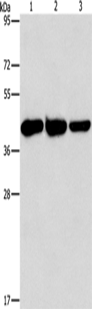 Western Blot analysis of Human normal liver tissue, Mouse brain and heart tissue using GOT1 Polyclonal Antibody at dilution of 1:1600