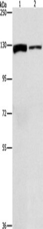 Western Blot analysis of A172 and PC3 cell using ACLY Polyclonal Antibody at dilution of 1:1050