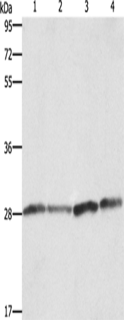 Western Blot analysis of Human placenta tissue and A549 cell, Raji and hela cell using BCAP31 Polyclonal Antibody at dilution of 1:750