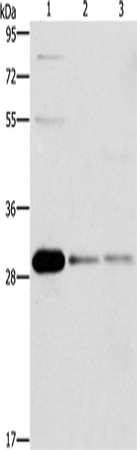 Western Blot analysis of HepG2, Raji and 293T cell using BCL10 Polyclonal Antibody at dilution of 1:950