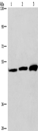 Western Blot analysis of adrenal pheochromocytoma tissue,Jurkat and A549 cell    using VWA5A Polyclonal Antibody at dilution of 1:275