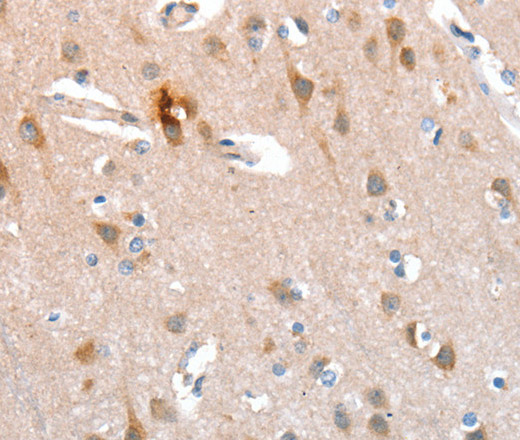 Immunohistochemistry of paraffin-embedded Human brain tissue using CD238 Polyclonal Antibody at dilution 1:40