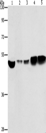 Western Blot analysis of Hela and A431 cell, Mouse brain and liver tissue, Mouse pancreas tissue using ENO1 Polyclonal Antibody at dilution of 1:500