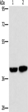 Western Blot analysis of Human fetal brain tissue and 231 cell using CAB39L Polyclonal Antibody at dilution of 1:350