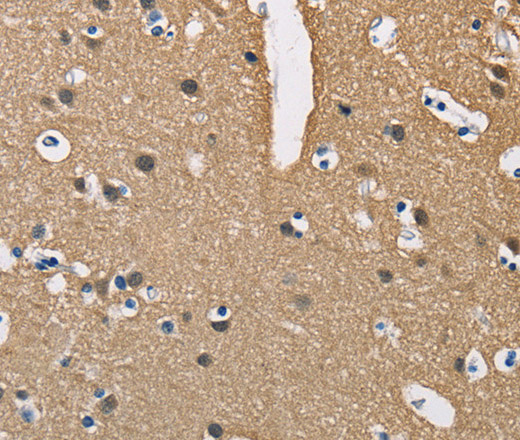 Immunohistochemistry of paraffin-embedded Human brain  using PPP3CA Polyclonal Antibody at dilution of 1:40