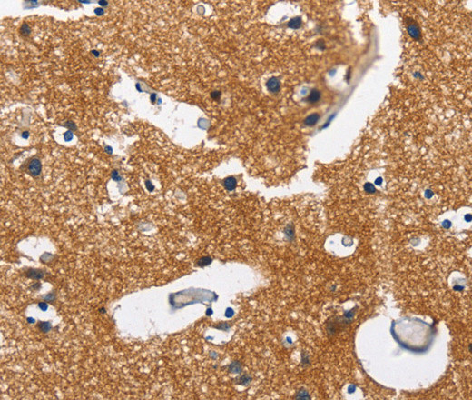 Immunohistochemistry of paraffin-embedded Human brain  tissue using CAMK1D Polyclonal Antibody at dilution 1:50