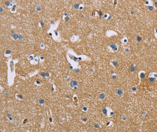 Immunohistochemistry of paraffin-embedded Human brain  using BSG Polyclonal Antibody at dilution of 1:60