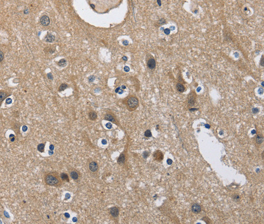 Immunohistochemistry of paraffin-embedded Human brain  using CD160 Polyclonal Antibody at dilution of 1:60