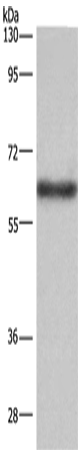 Western Blot analysis of Mouse liver tissue using SIGLEC5 Polyclonal Antibody at dilution of 1:350