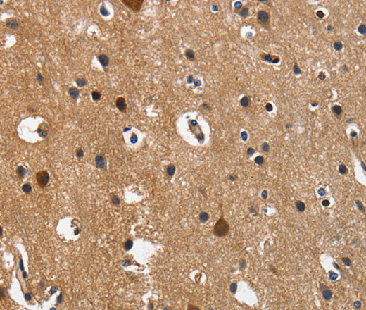 Immunohistochemistry of paraffin-embedded Human brain  using CD27 Polyclonal Antibody at dilution of 1:60