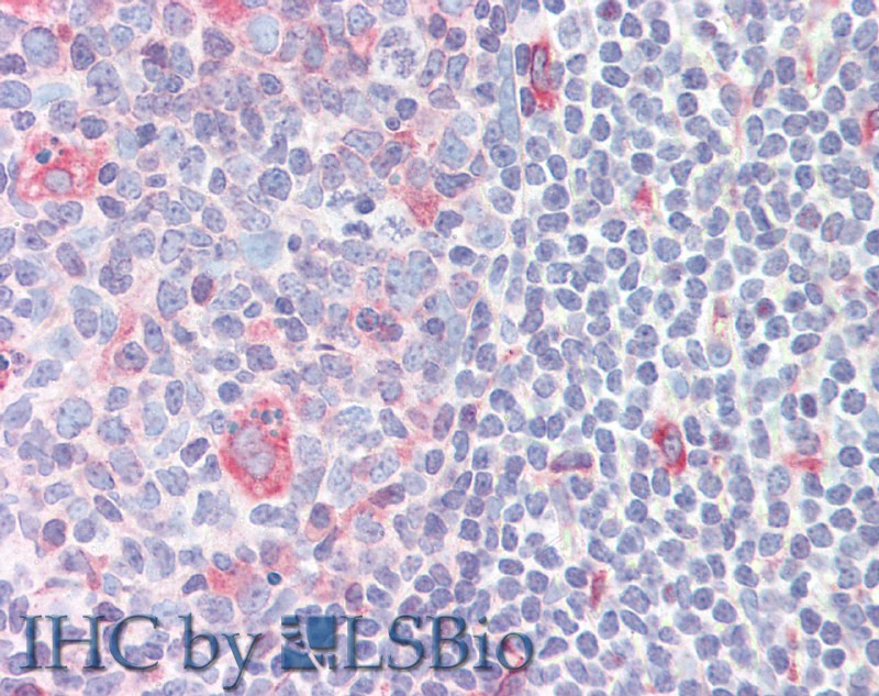 Immunohistochemistry of paraffin-embedded Small Intestine (MALT) tissue using CD272 Polyclonal Antibody at dilution of 1:50 .