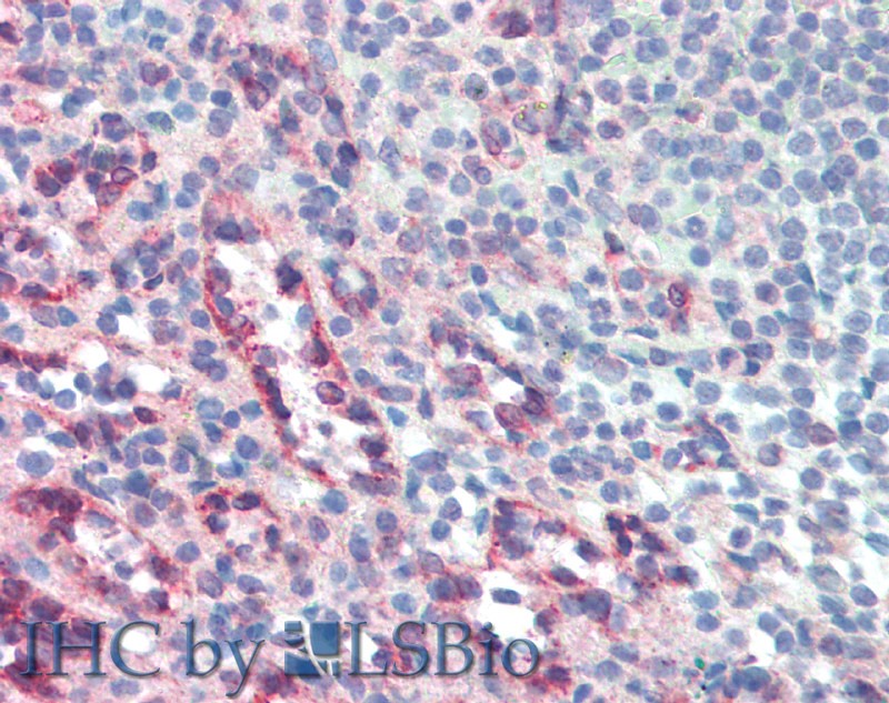 Immunohistochemistry of paraffin-embedded Small Intestine (MALT) tissue using CD272 Polyclonal Antibody at dilution of 1:50 .