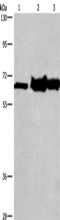 Western Blot analysis of 231 cell, Mouse kidney and liver tissue using CHDH Polyclonal Antibody at dilution of 1:500