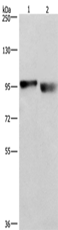 Western Blot analysis of A431 and lovo cell using KIAA1524 Polyclonal Antibody at dilution of 1:597