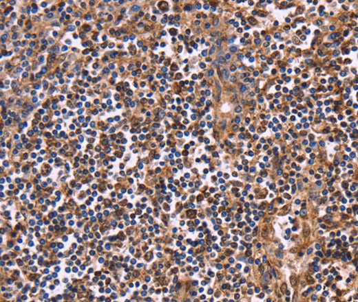 Immunohistochemistry of paraffin-embedded Human tonsil using CLUAP1 Polyclonal Antibody at dilution of 1:50