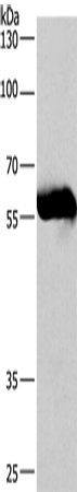 Western Blot analysis of Lovo cell  using CORO1C Polyclonal Antibody at dilution of 1:530